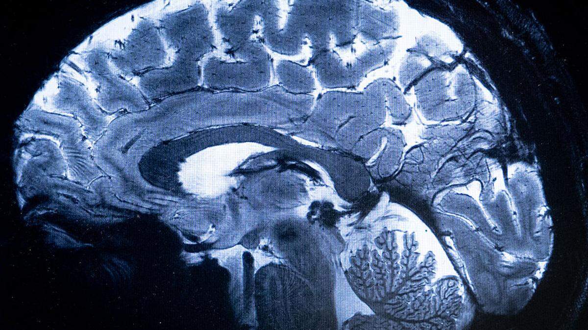 UC Berkeley traced the exact brain circuits behind your nightly growth hormone surge — and what they found is more elegant than anyone expected.
