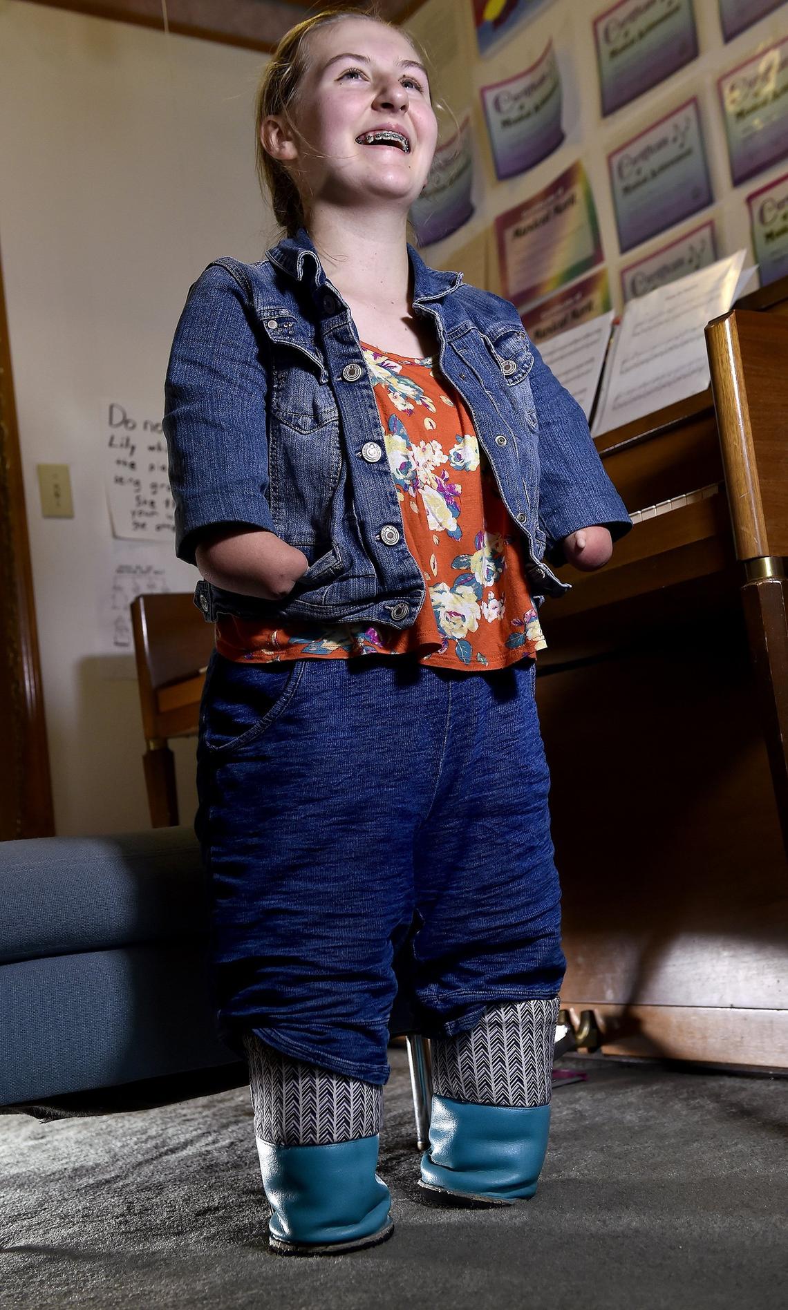 Prosthetics don’t work well for Heidi Burke, so a friend created shoes to protect her skin.