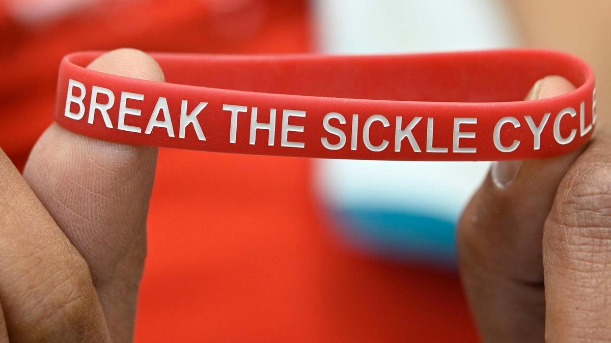 Sickle cell patient Kevin Wake wears a sickle cell awareness bracelet.