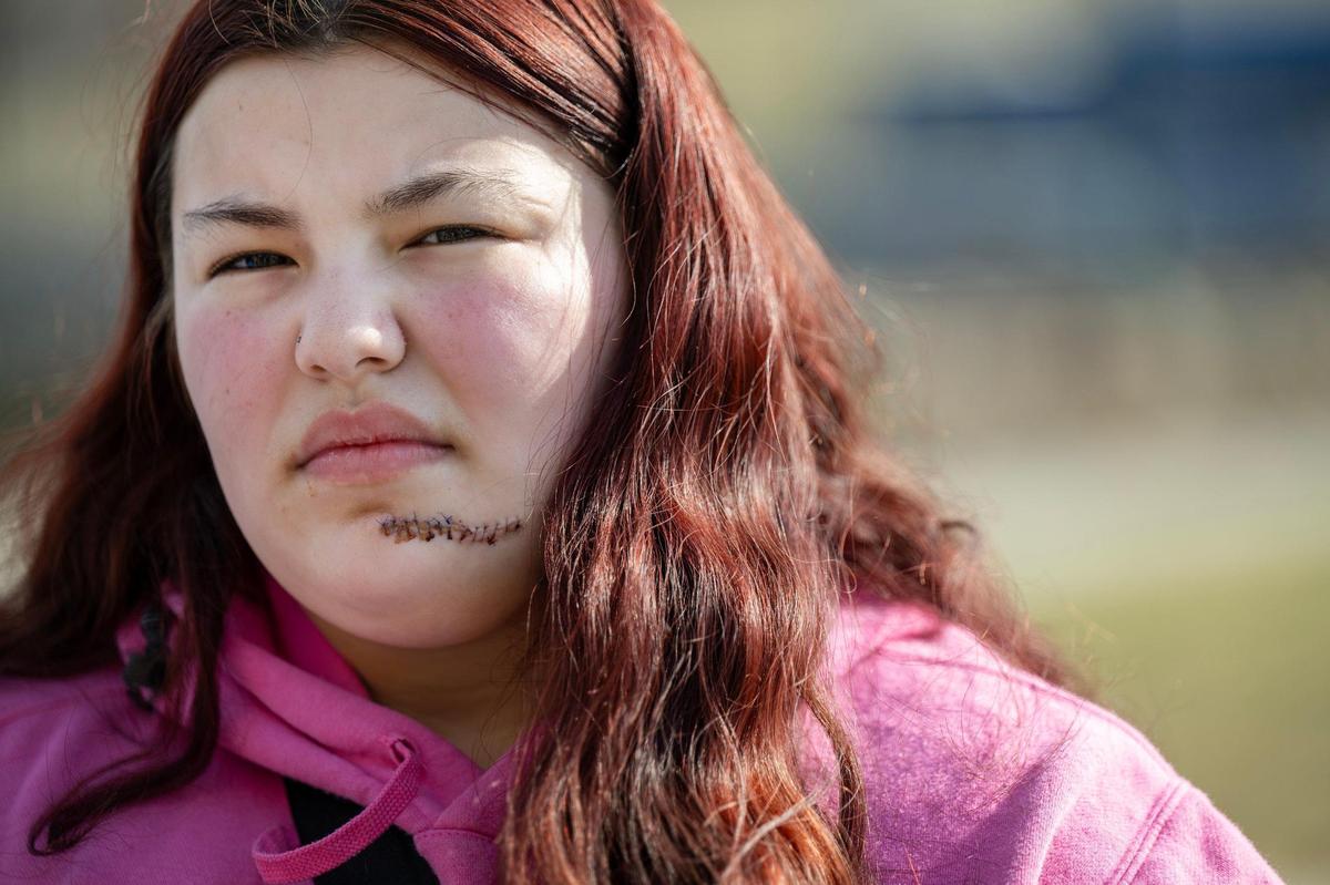 Mireya Nelson, 15, of Belton, Missouri, was shot during the Chiefs Super Bowl Rally last week at Union Station. She stopped by the memorial for the shooting victims in the parking lot of Union Station on Wednesday, Feb. 21, 2024, on her way to a doctor’s appointment at Children’s Mercy Hospital. Mireya sustained a gunshot would through her jaw which traveled into her shoulder.