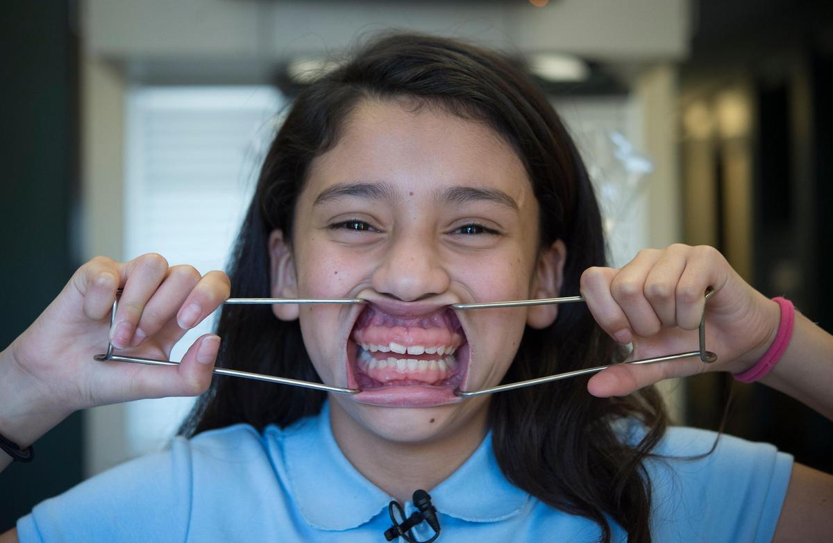 Yuliana Alvarado, 11, displays her teeth for a “before” picture prior to getting braces through Smiles Change Lives. Classmates had bullied her, calling her “beaver teeth” and making fun of her bulging gums. “It hurt me,” she said.