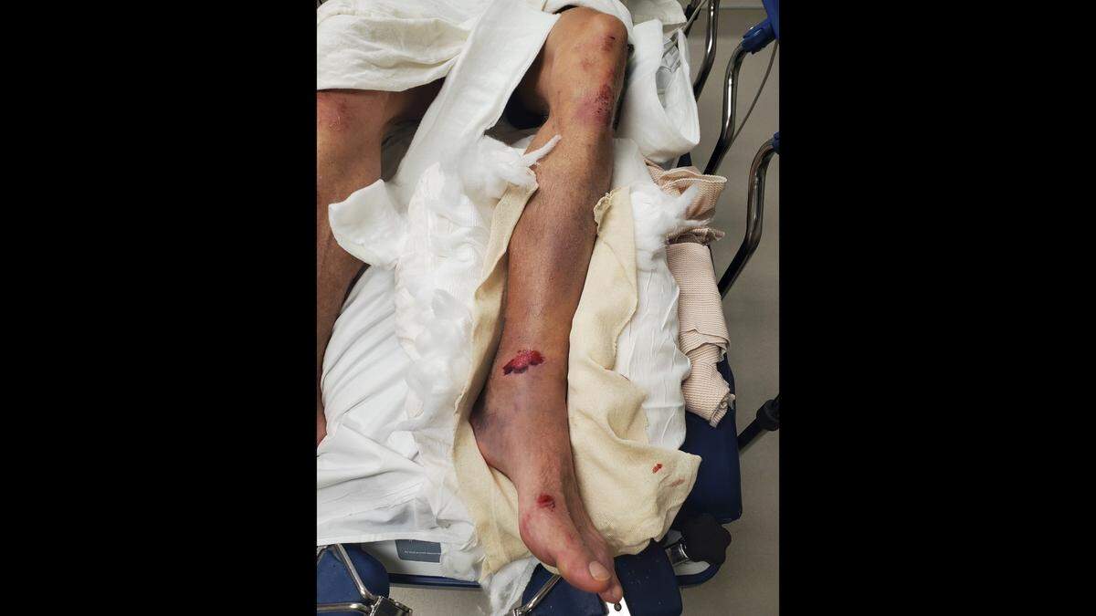 Johnathan Scaletty, of Lee’s Summit, said he was attacked in the parking lot of Arrowhead Stadium ahead of the Luke Combs concert on Saturday. It took an ambulance about an hour to arrive, said Scaletty, who suffered multiple broken bones in his ankle.