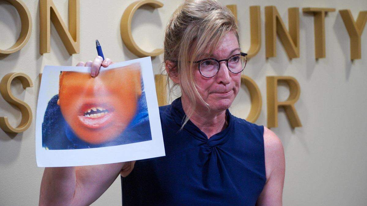 Jackson County Prosecutor Jean Peters Baker holds photo evidence showing broken teeth of a 15-year-old who was allegedly kneeled on by a Kansas City police sergeant last November. A Jackson County grand jury indicted Matthew T. Neal on August 21, 2020, for third-degree assault.