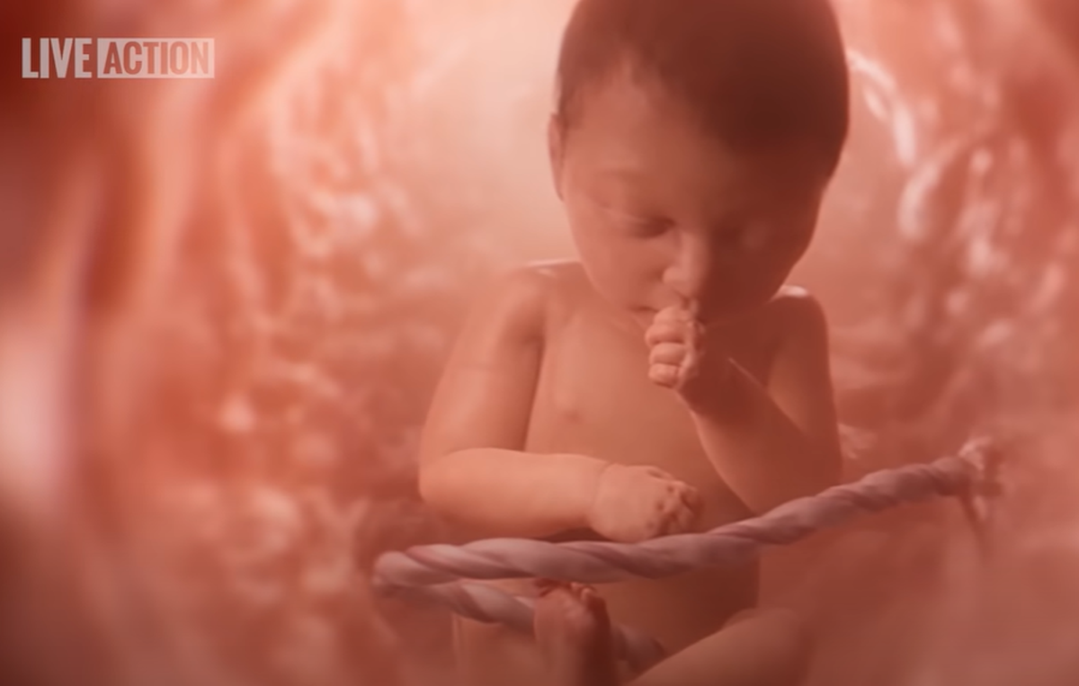 Screenshot of the “Baby Olivia” video produced by anti-abortion group Live Action. Similar videos are now required in Kansas public school biology and sex ed classes.