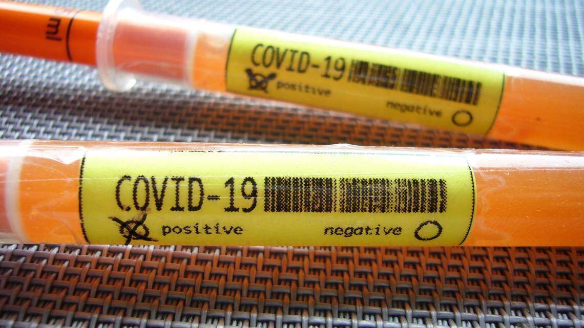 Unauthorized COVID-19 testing in Fairview Heights raises concerns about possible scam