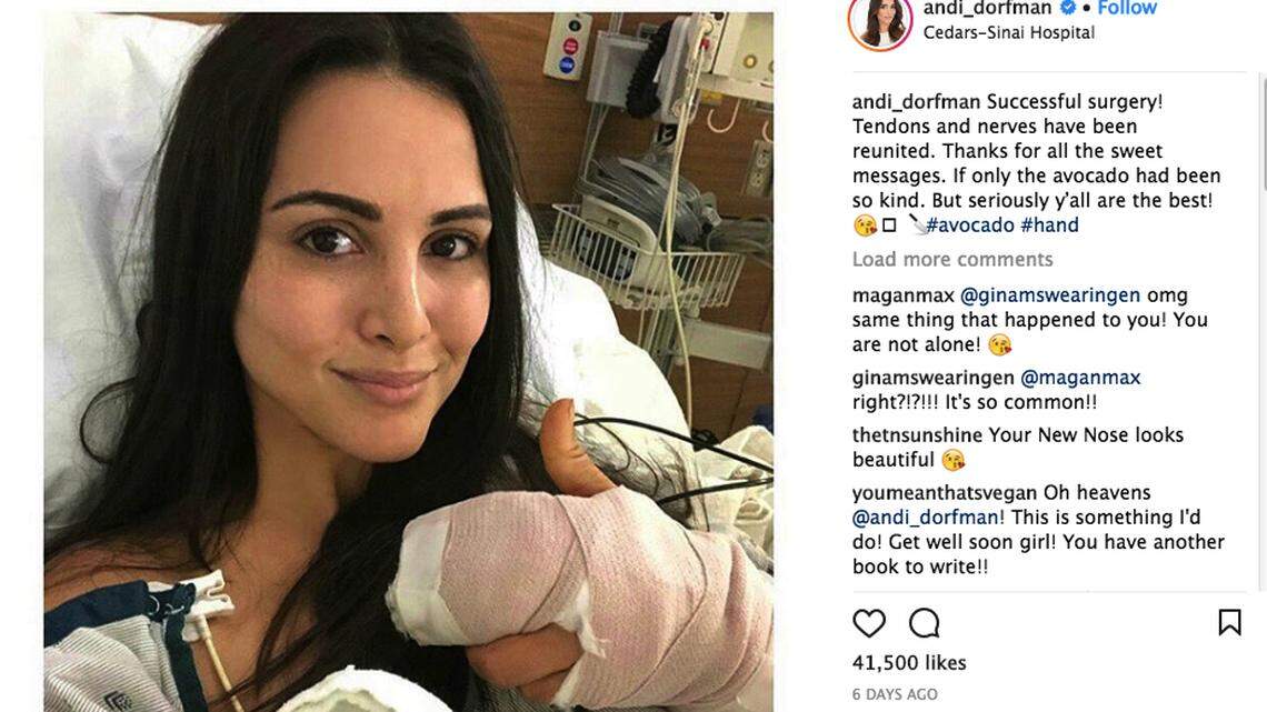 Joy Behar of "The View" was hospitalized after she cut her hand trying to get the pit out of an avocado with a knife. Former "Bachelorette" Andi Dorfman, shown here, had hand surgery last week for the same thing, too. Avocado Hand strikes again.