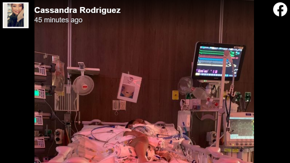 J.J. Rodriguez, 1, was attacked by a neighbor’s pit bull, his family said.