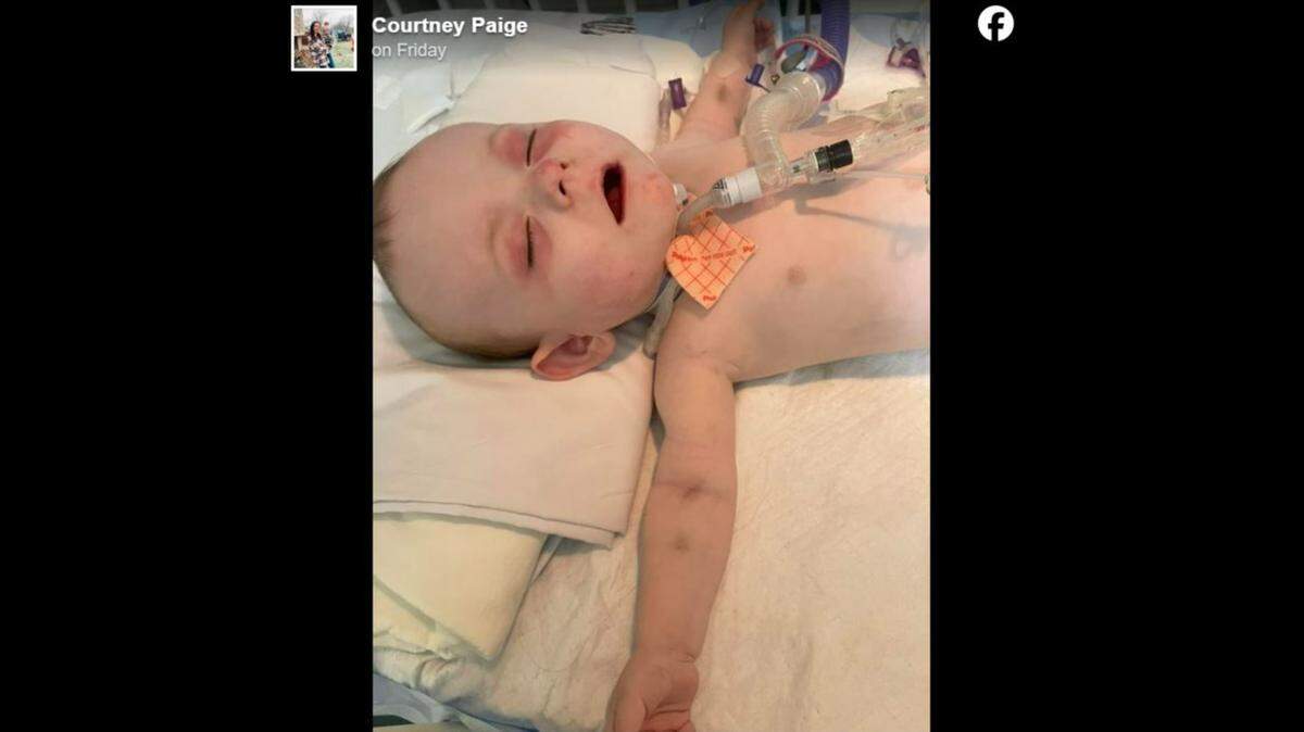 An Ohio family says a case of mistaken identity led to police raiding their home, sending an 17-month-old toddler to the intensive care unit.