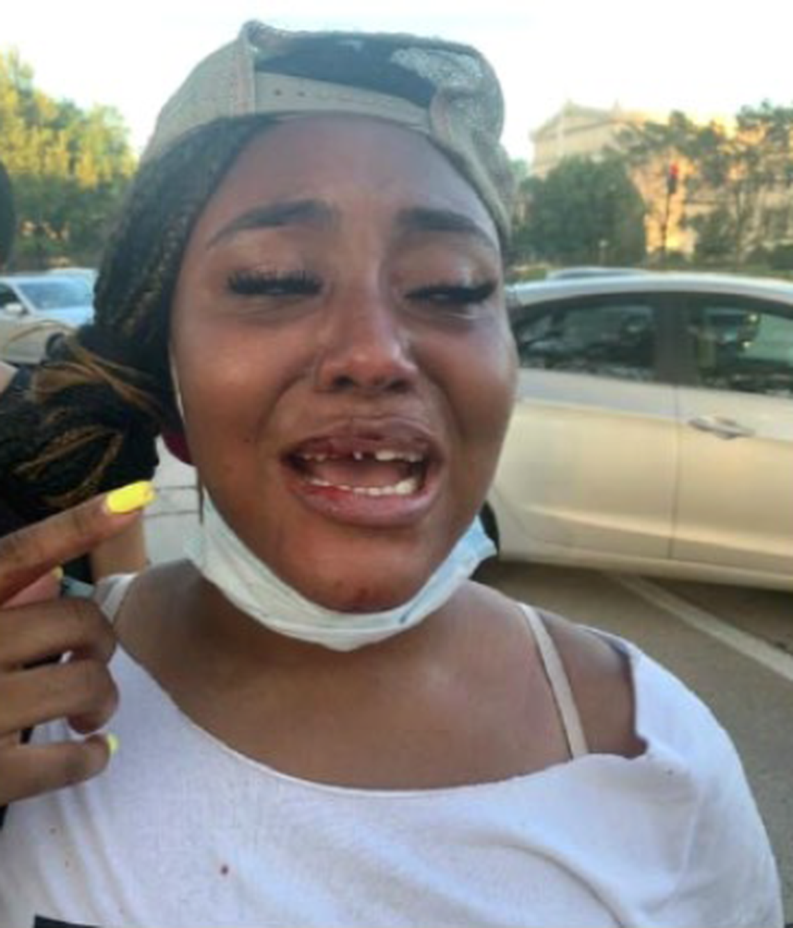 Miracle Boyd was struck in the face by a Chicago police officer during a 2020 protest, according to a lawsuit filed in 2024.