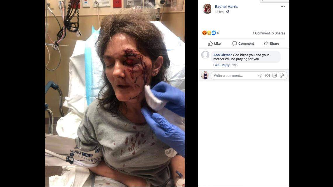 Rachel Harris says a man broke into her paralyzed mother’s home and brutally beat her.