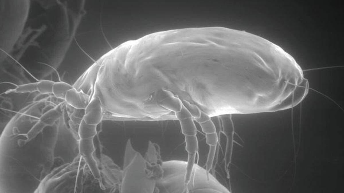 
Fortunately, you won’t see house dust mites quite this big in real life; this side view of a house dust mite was seen through an electron microscope. Although the thought of sleeping with millions of dust mites is just plain gross, for most of us it’s not dangerous. For those with allergies, however, the symptoms can be serious.
