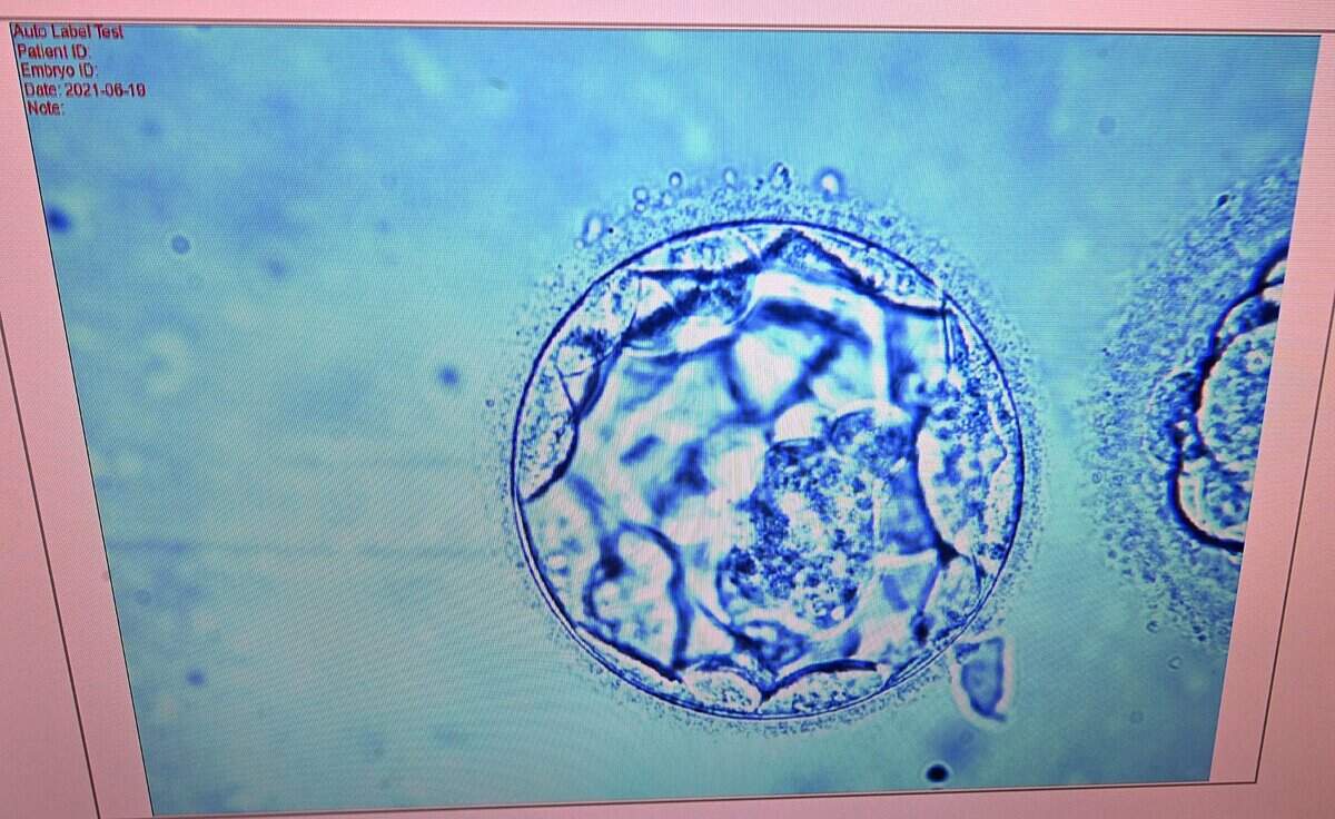 A photo of an embryo.