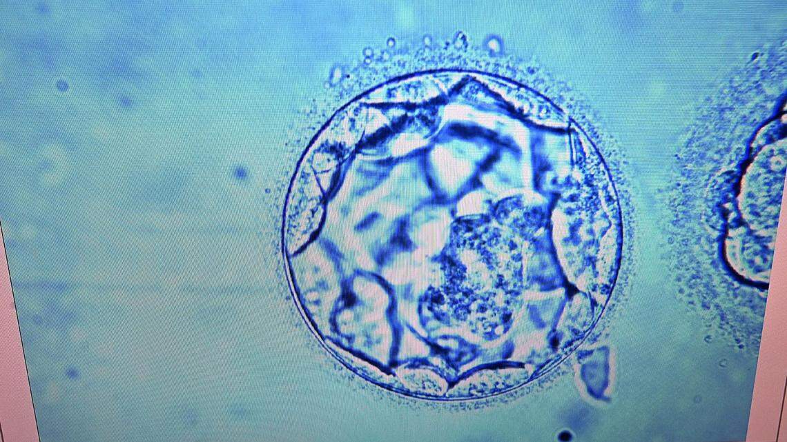 A photo of an embryo.