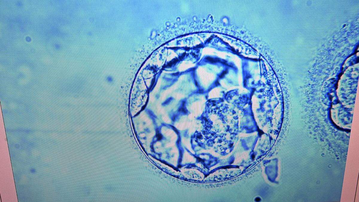 A photo of an embryo.