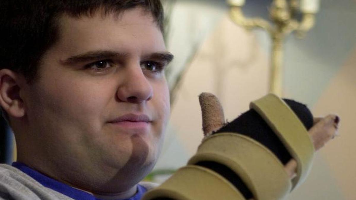Andy Marso discussed his recovery from meningitis during a news conference at the Overland Park home of one of his doctors. Pressure garments cover Marso's hands and forearms after he had to have nine of his fingers amputated.