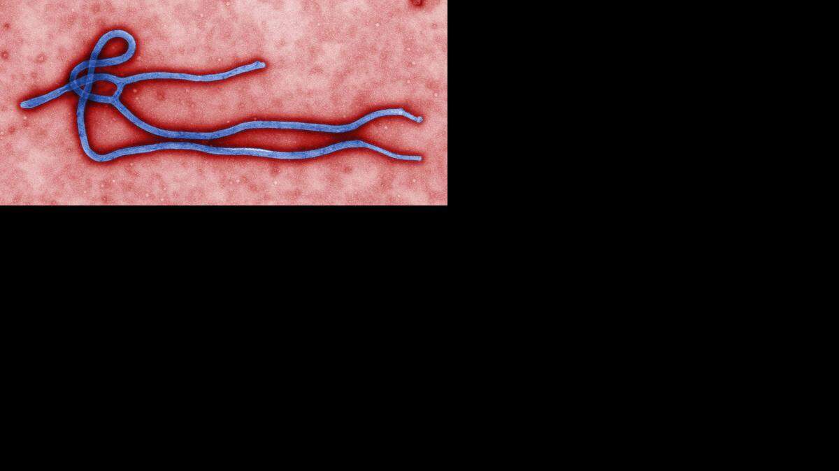 
Ebola virus
