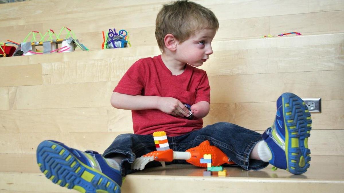 Sven Johnson, 4, builds with Legos on the artificial hand that Blue Valley CAPS students built for him.