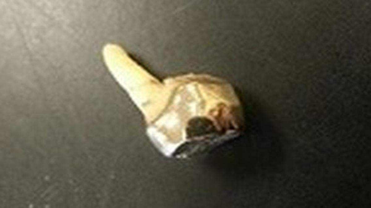 
Someone dropped this gold tooth in a Salvation Army kettle on Wednesday in Kansas City, North.
