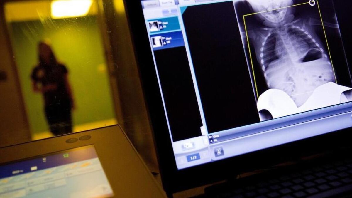A radiology technician looks at a chest X-ray of a child suffering from flu symptoms at Upson Regional Medical Center in Thomaston, Ga., Feb. 9. A government report out Friday shows 1 of every 13 visits to the doctor last week was for fever, cough and other symptoms of the flu.