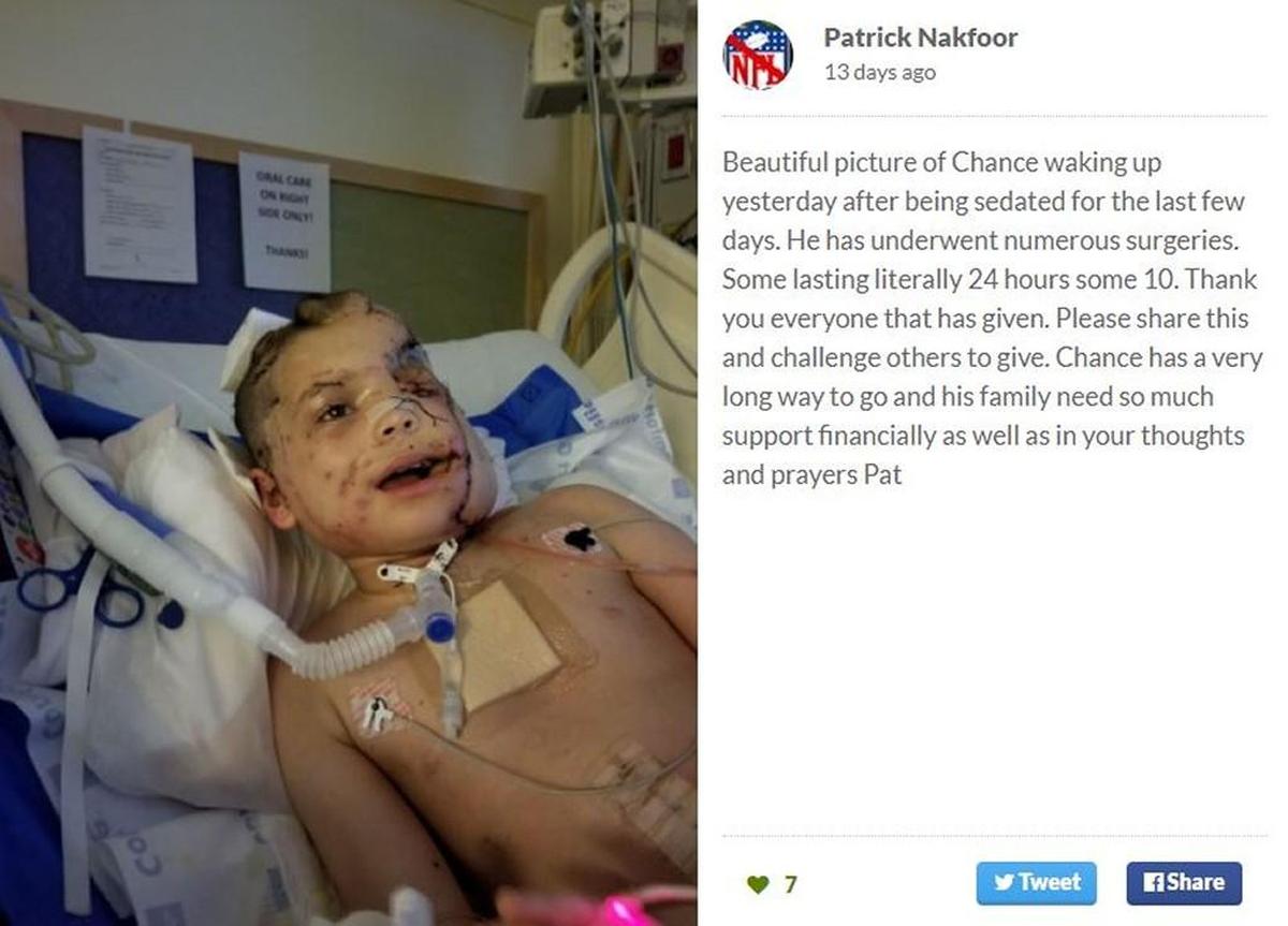 Chance Orozco suffered severe injuries to his face and neck and faces a long recovery. A GoFundMe account was created to contribute to the family’s medical expenses.