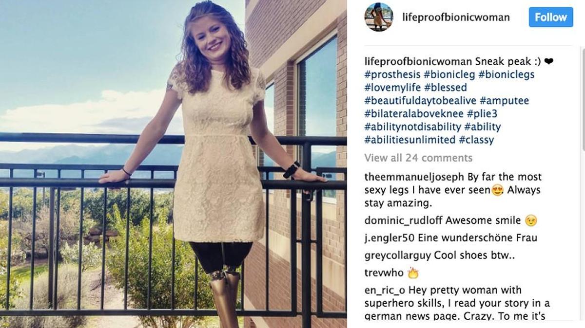 Mandy Horvath is up-front in her Tinder profile - she doesn’t have legs. “I’ll never run away from you,” she writes in a funny profile that is scoring her lots of attention and dates.