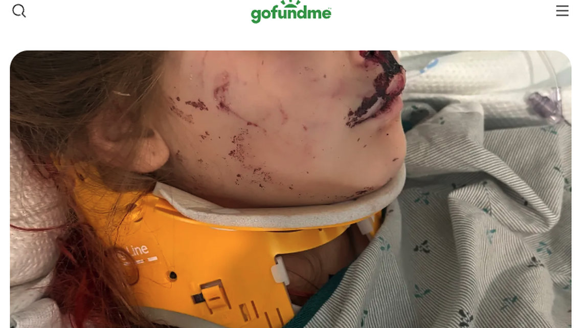 Family member said they are “grateful that she is alive” after a car crashed into Laila Breitshtrus’ bedroom as she was sleeping.