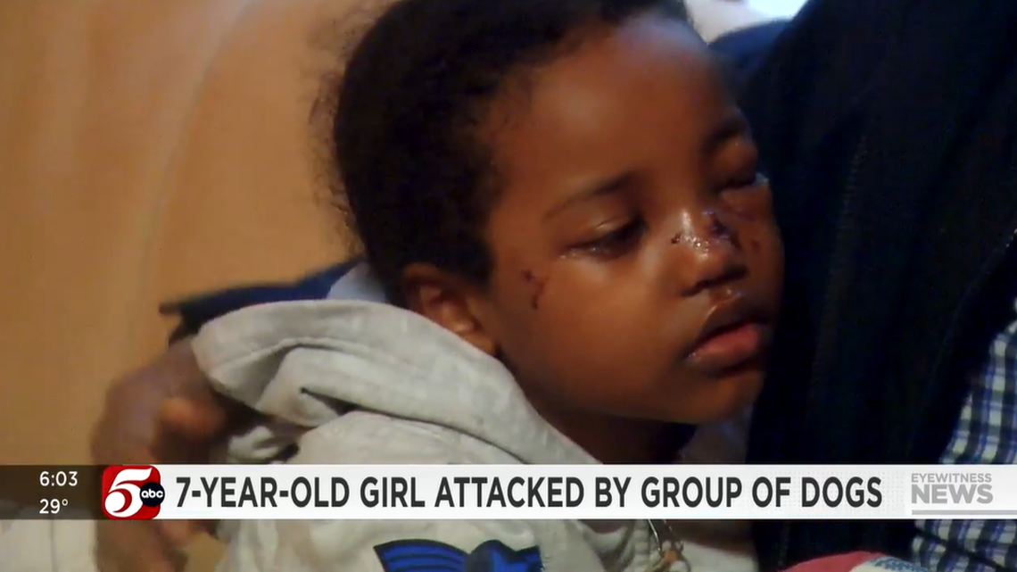 A 7-year-old girl is recovering after police and family say she was attacked by a group of dogs walking home from a school bus stop.