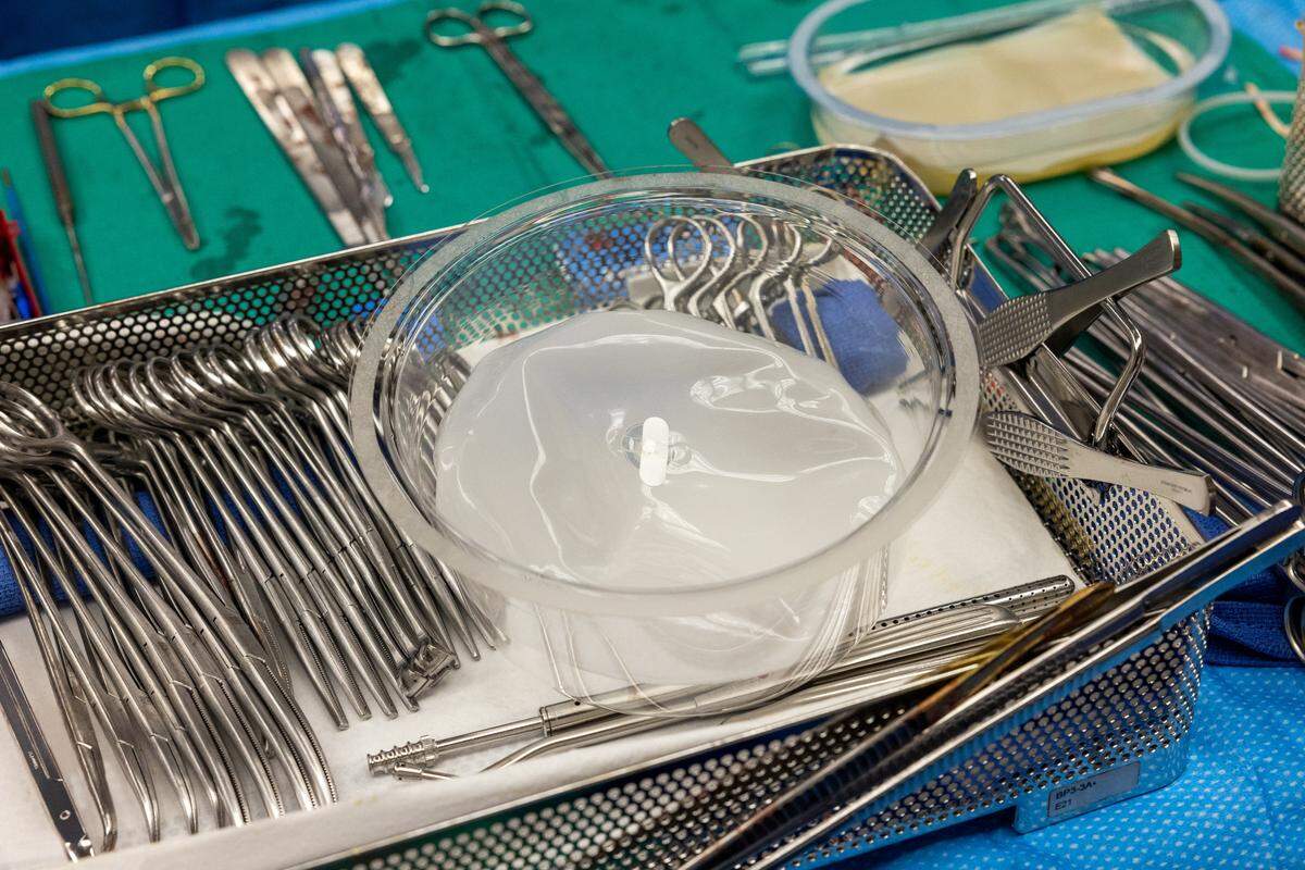 Unsure how to keep Bauer’s heart in place with his lungs removed, a plastic surgeon suggested using breast implants, according to a news release.