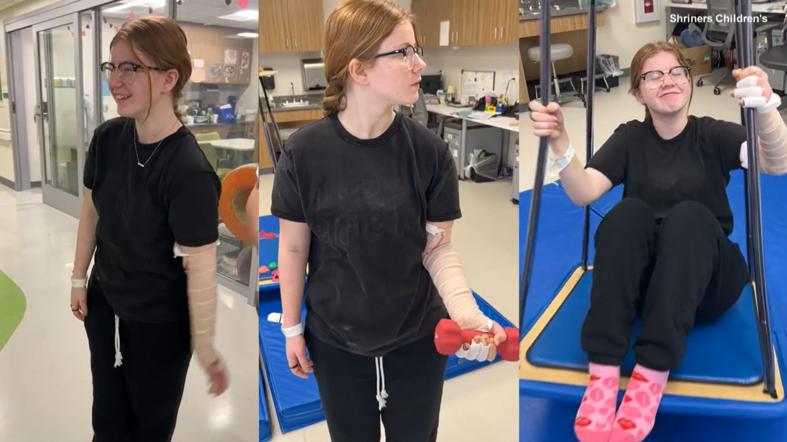 A 14-year-old girl in Ohio is recovering after she caught on fire when using nail polish remover next to a burning candle.