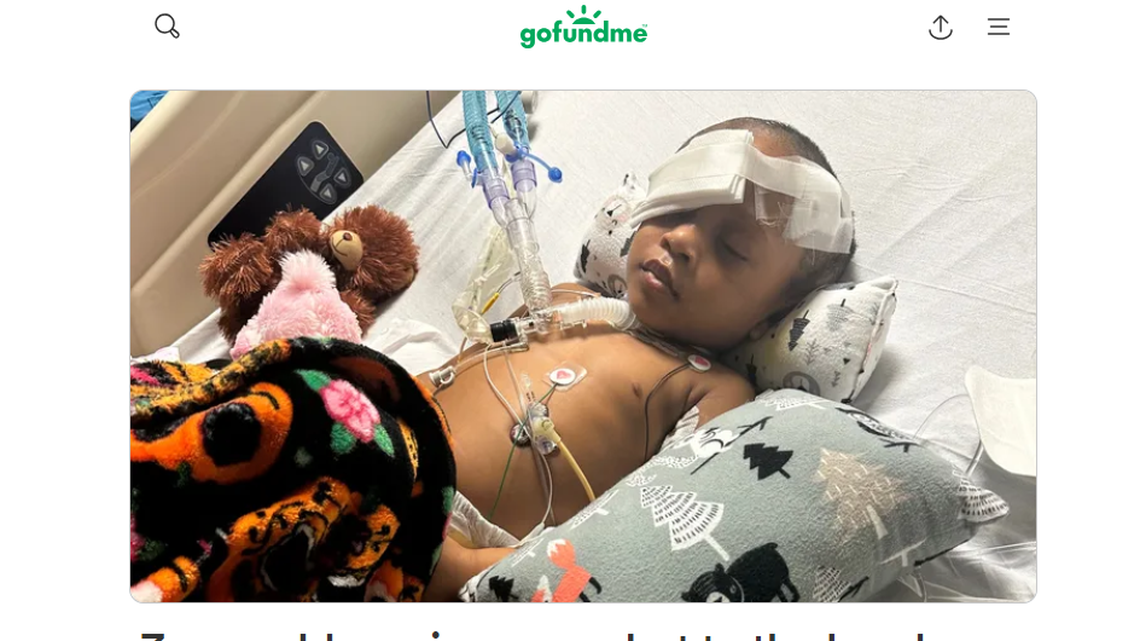 Three-year-old Skye McBride fights for her life after accidentally shooting herself with her father’s gun, family says.