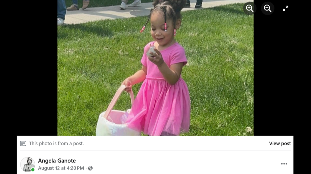 A 3-year-old girl is fighting for her life after officials say she was found stiff, emaciated and bruised in her father and stepmother’s care.