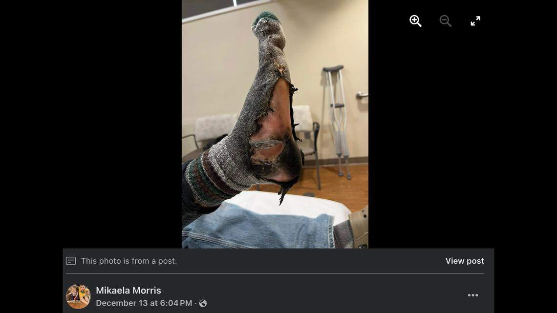 Mikaela Morris says her husband was severely burned from rechargeable heated insoles that were inside his shoes.