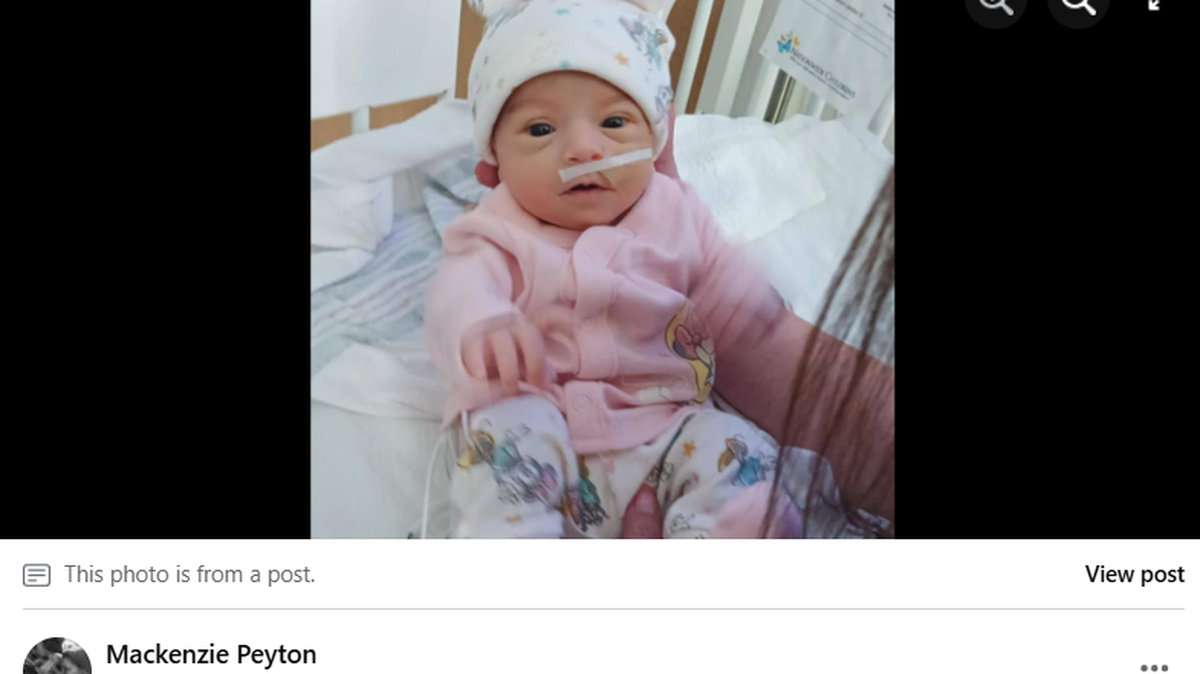Baby Ellieana Peyton died after an accidental fall at an Ohio hospital, a coroner’s report said.