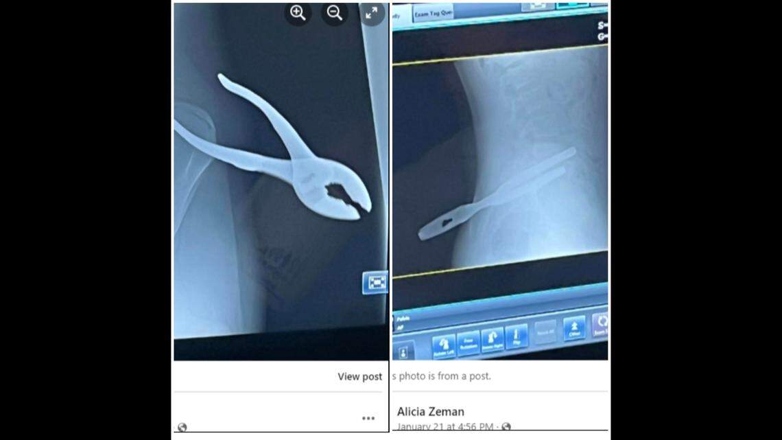 A teenager was impaled by a pair of pliers after slipping and falling on ice in WaKeeney, Kansas, his family says.