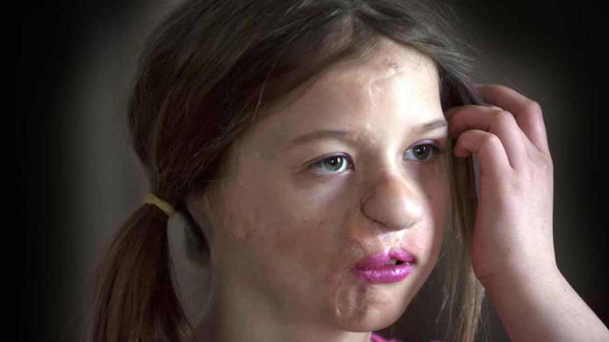 
In this April 14 photo, Charlotte Ponce is at her home the day before surgery in Royal Oak, Mich. 
