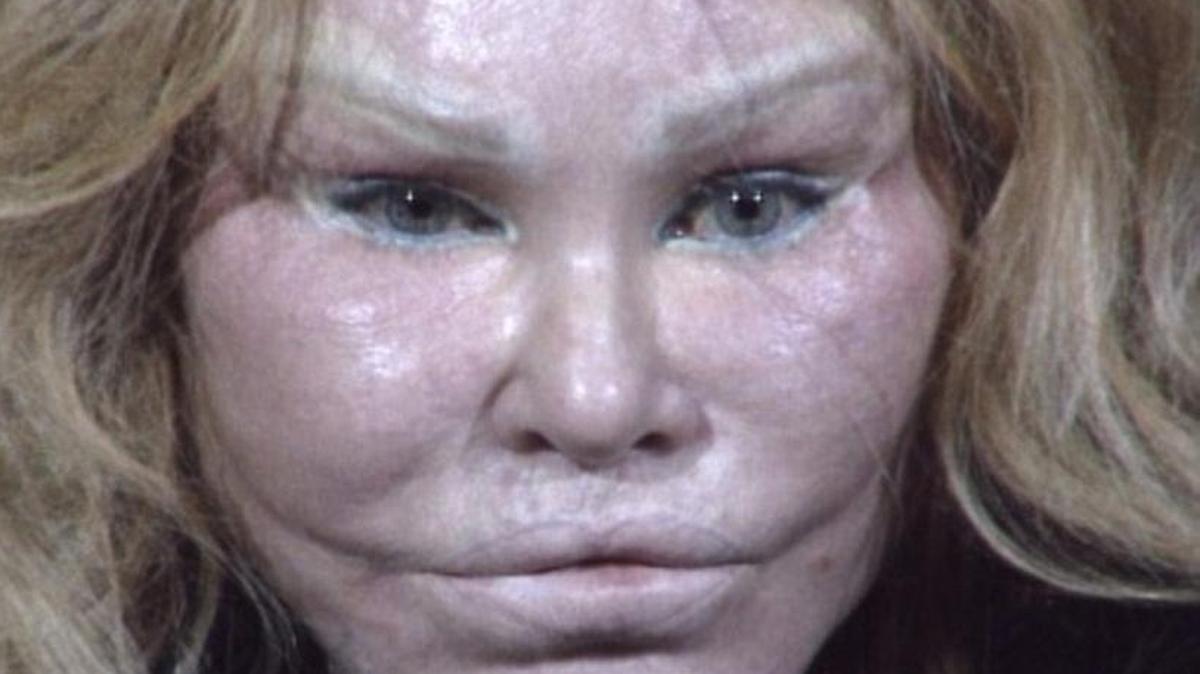 Jocelyn Wildenstein