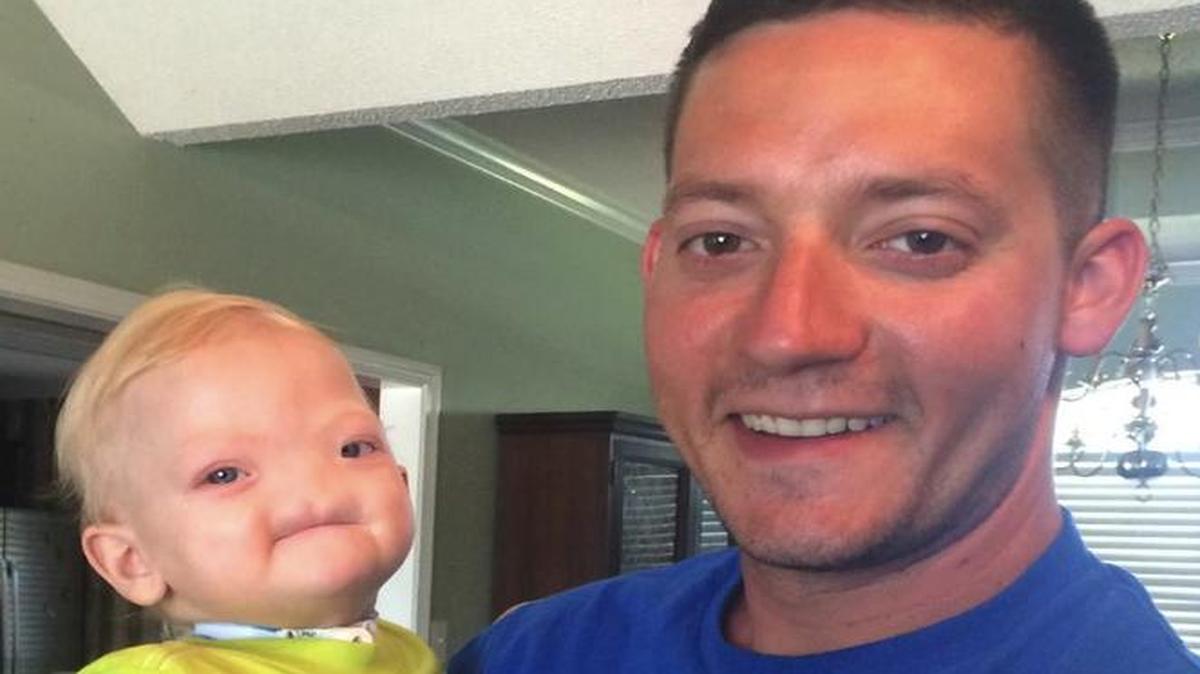 Two-year-old Eli Thompson, who made worldwide headlines when he was born without a nose, died on Saturday night. “He touched a lot of people’s lives. A lot of people cared about him,” said his father, Jeremy Finch, on Facebook.
