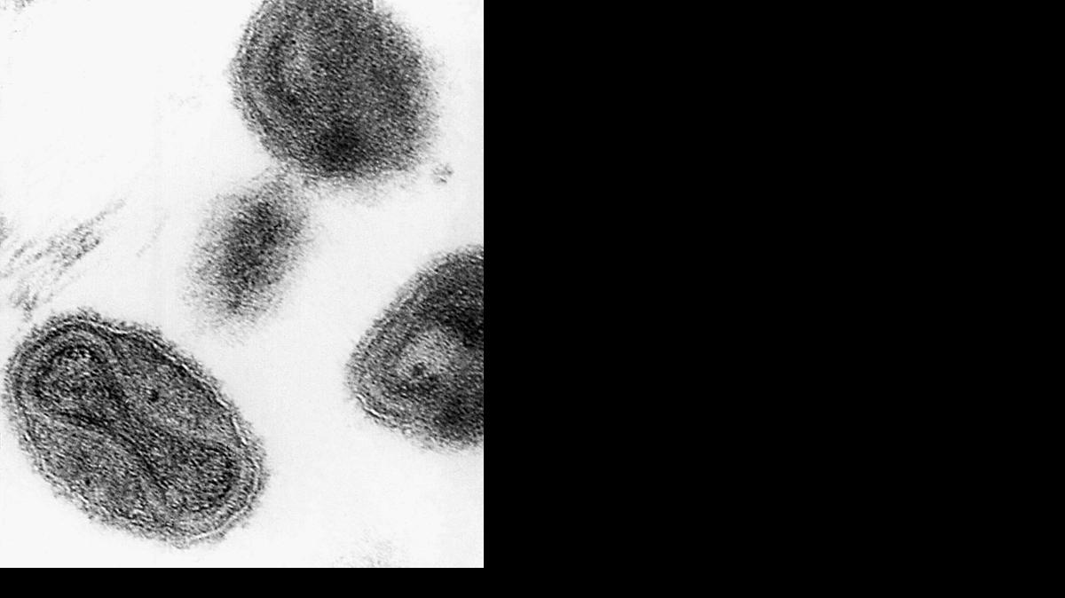 
This 1975 file electronmicrograph from the Centers for Disease Control and Prevention shows the smallpox virus. Workers cleaning a storage room at the National Institute of Health’s campus in Maryland made a startling discovery last week: decades-old vials of smallpox forgotten in a cardboard box.
