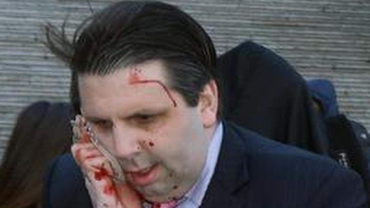 
Mark Lippert (center), the U.S, ambassador to South Korea, got into a car to leave for a hospital after a man wielding a razor attacked him Thursday in Seoul, South Korea. The attacker screamed that the two Koreas should be unified.
