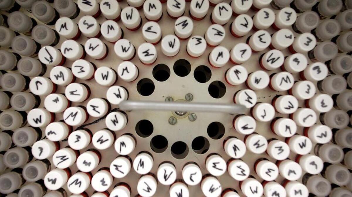 A tray of samples marked with an “M” for mumps