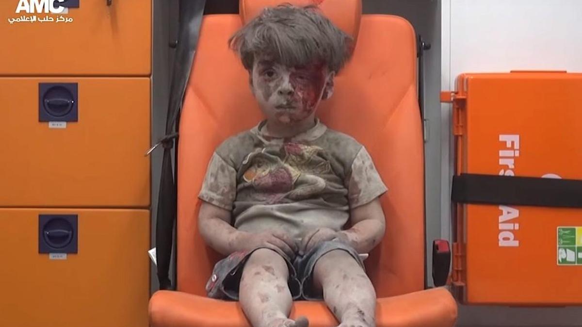 Omran Daqneesh, a 5-year-old Syrian child, sat in an ambulance after a house was destroyed in an airstrike last week in Aleppo, Syria.