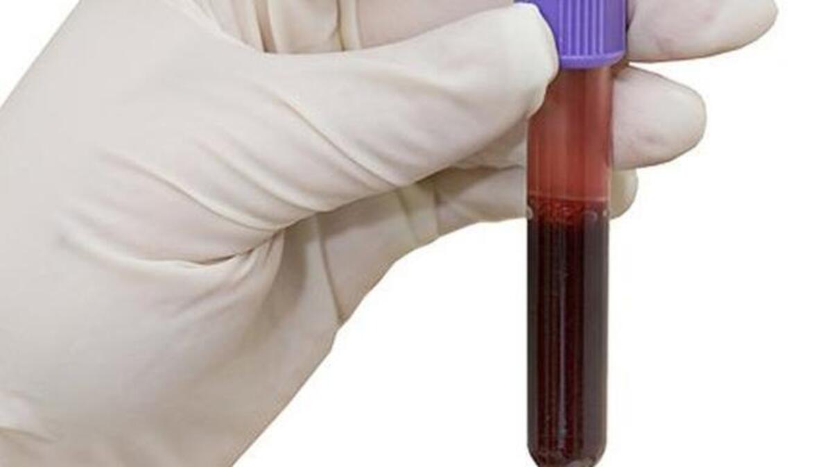 A simple blood test can tell you if you have a genetic risk for cancer, but the medical community usually only recommends genetic testing after a cancer diagnosis.