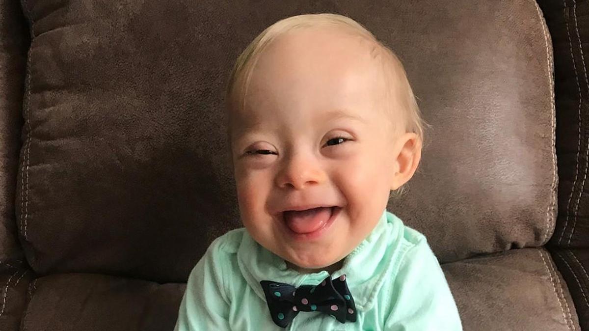 Lucas Warren, a 14-month-old who has Down syndrome, was Gerber baby food’s “spokesbaby” in 2018..