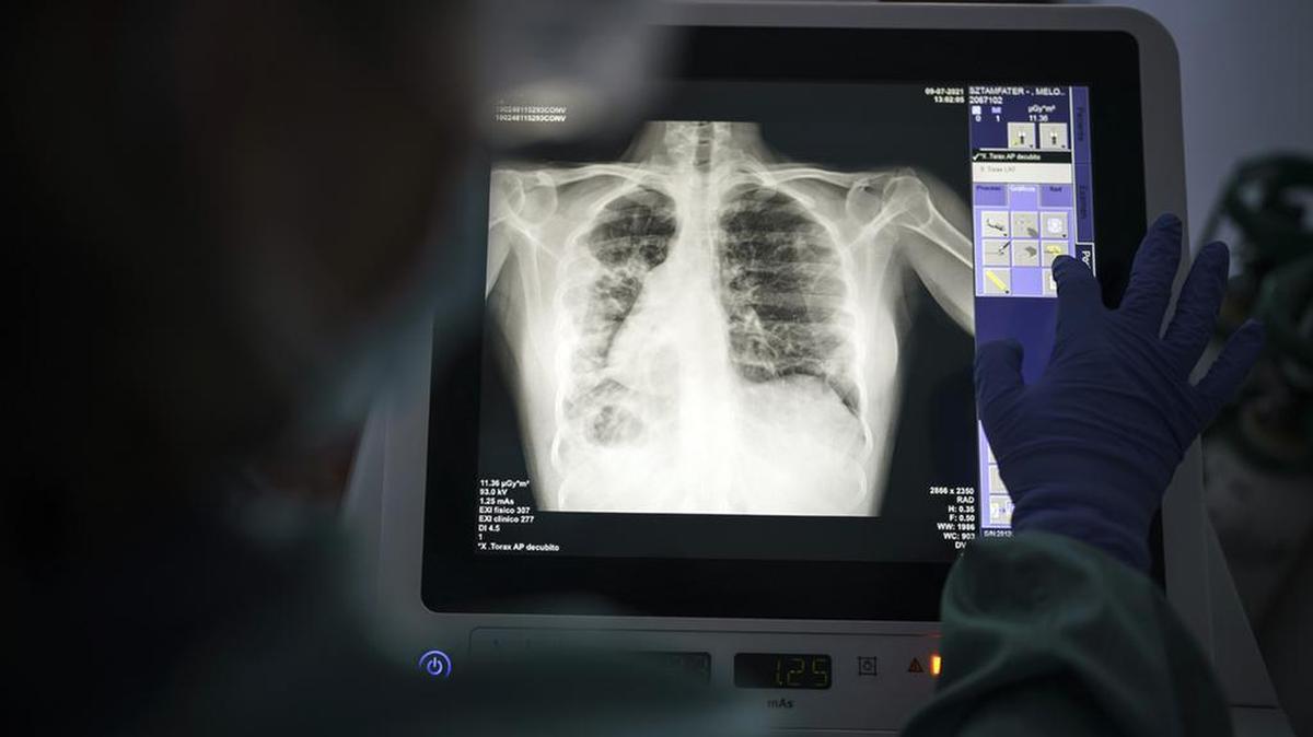 FILE - In this Friday, July 9, 2021 file photo, a health worker checks the x-ray of a 34-year-old COVID-19 patient. Kansas Gov. Laura Kelly has announced the U.S. Department of Veterans Affairs has agreed to allow non-VA patients access to VA ICU beds. (AP Photo/Felipe Dana, File)