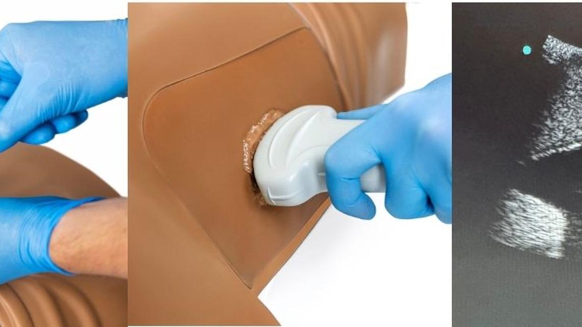 Simulab Launches TraumaMan(R) System Ultrasound Module for Realistic Trauma Training 