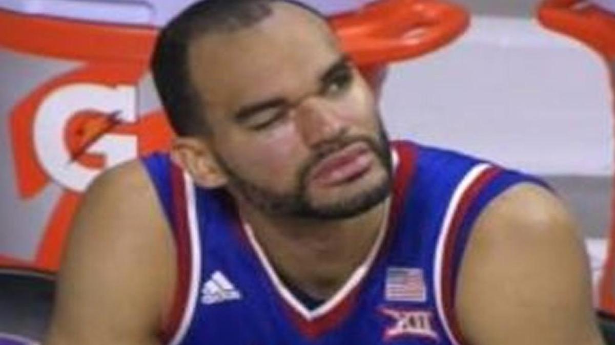 Perry Ellis’ eye looked terrible on Saturday night.