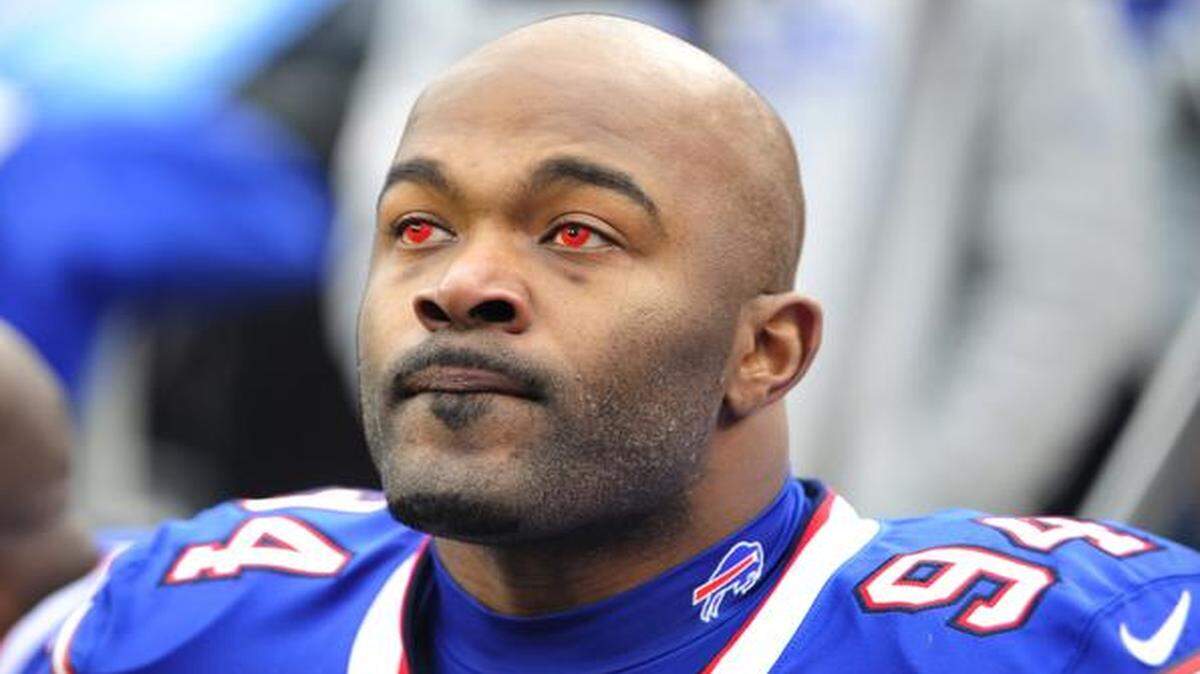 
Buffalo Bills defensive end Mario Williams wore color contacts during Sunday’s game against the Chiefs.
