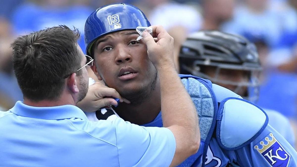Kansas City Royals catcher Salvador Perez has his eye flushed out to remove something in the fourth inning of Saturday’s game. There was nothing wrong with his eyes on a key pickoff throw in the eighth inning.